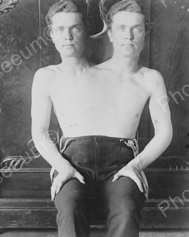 Conjoined Two Headed Man 1901 8x10 Reprint Of Old Photo - Photoseeum