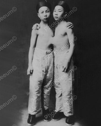 Korean Conjoined Siamese Twins 1900s 8x10 Reprint Of Old Photo - Photoseeum